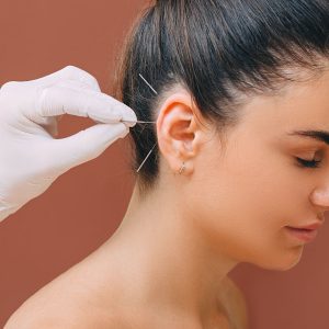 Acupuncturist treats a patients illness with acupuncture at special points on her ear. Acupuncture - alternative medicine